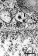 写真：顕微鏡で見るデングウイルス