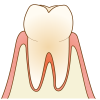 イラスト:健康な歯