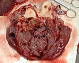 写真：細菌によりいぼができた心臓